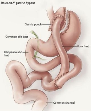 https://ahmetziyabalta.com/wp-content/uploads/2025/07/gr1_lrg-320x391.jpg
